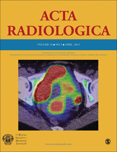 CT angiogram findings in carotid-cavernous fistulas: stratification of ...